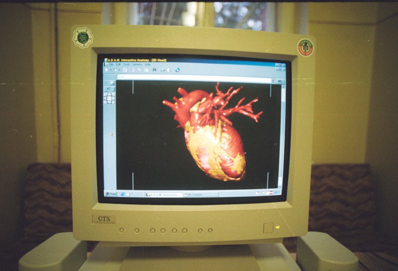 LU Medicīnas fakultātes Anatomijas un histoloģijas katedra. Medicīnas mācību datorprogrammas attēls.