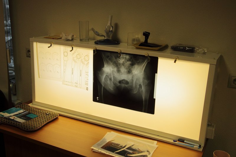 Latvijas Universitātes Medicīnas fakultātes Diagnostikas darba stacijas atklāšana Traumatoloģijas un ortopēdijas slimnīcas 
telpās.<br>
Darba stacija paredzēta ortopēdisko un radioloģisko attēlu interpretācijai ārstniecības studentu apmācībai. Gaismas panelis, kas iepriekš ticis izmantots ortopēdisko un radioloģisko attēlu interpretācijai.